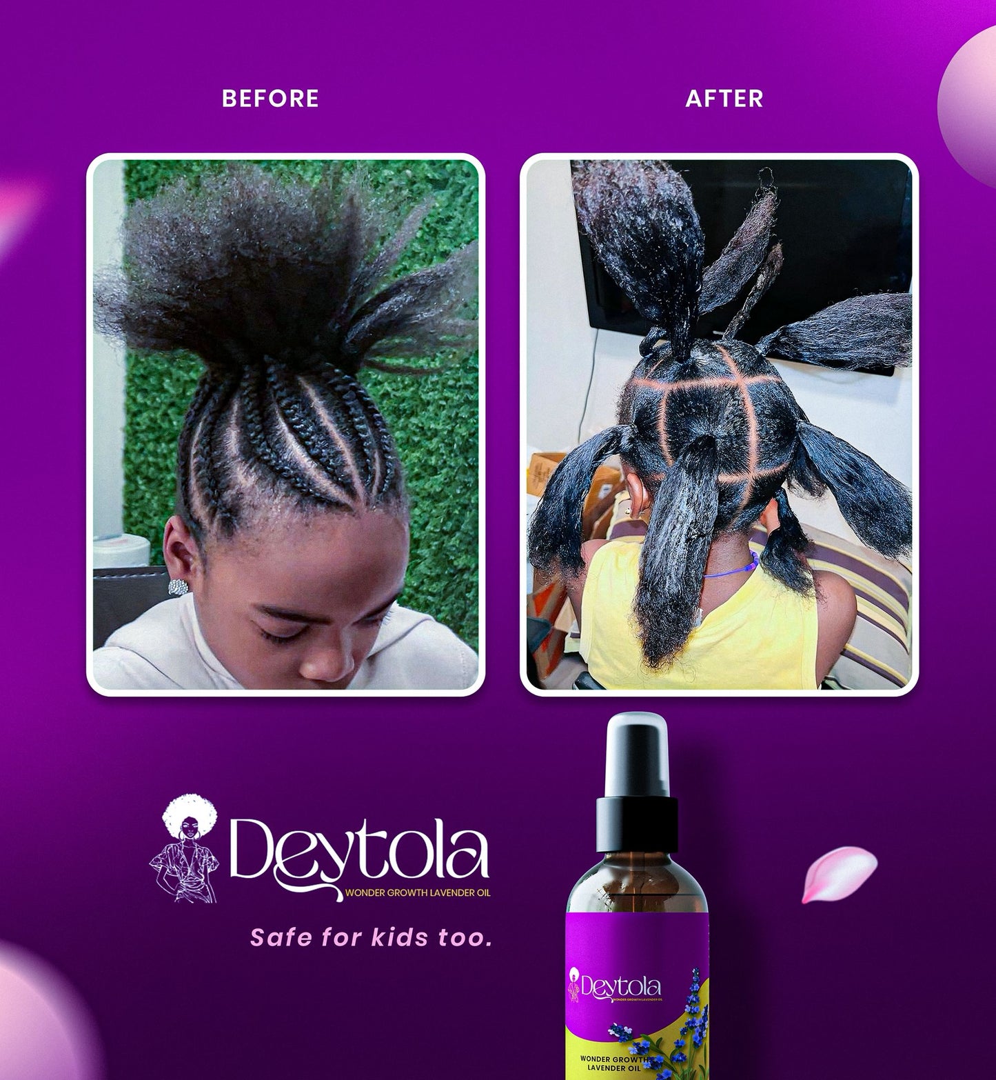 Deytola Wonder Growth Hair Oil