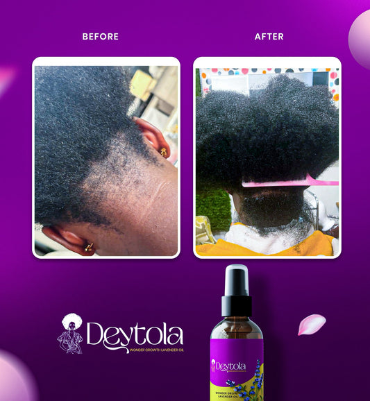 Deytola Wonder Growth Hair Oil